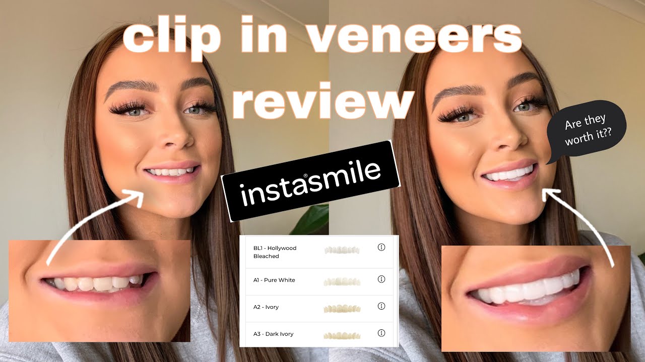 clip on veneers reviews