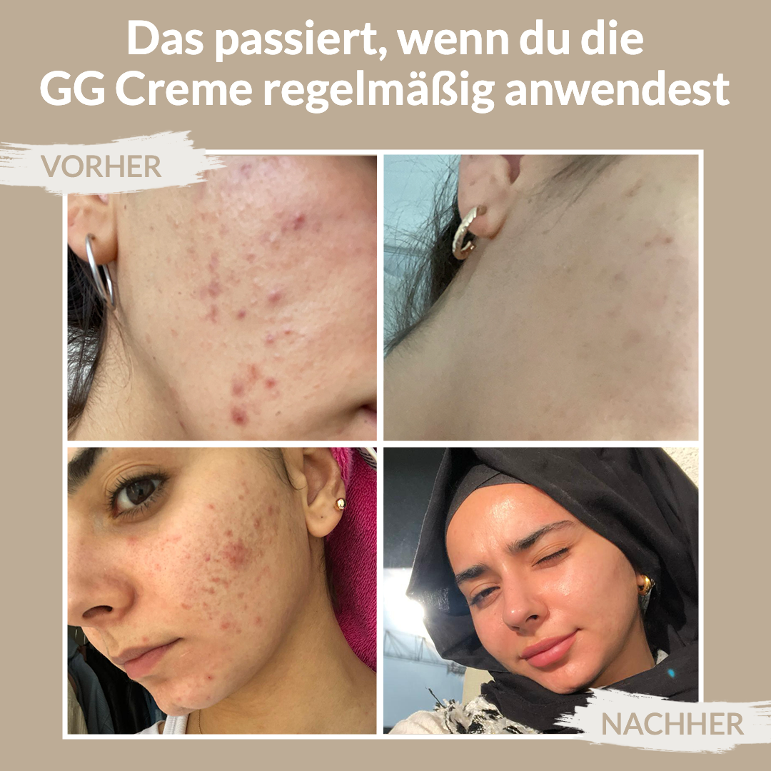 gg cream gloria erfahrungen