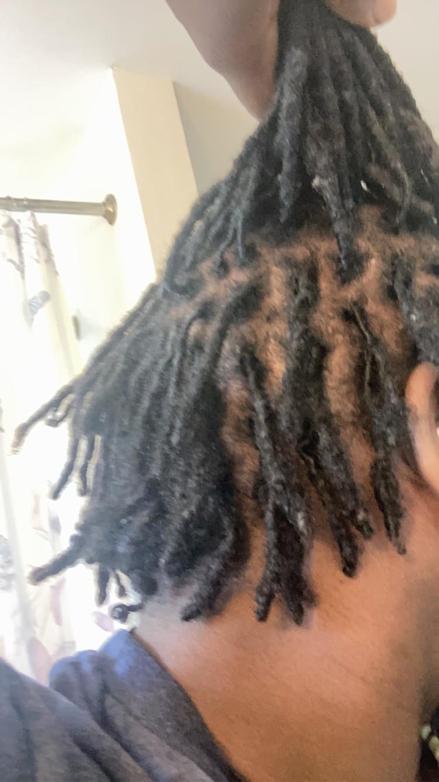 growing out undercut with locs