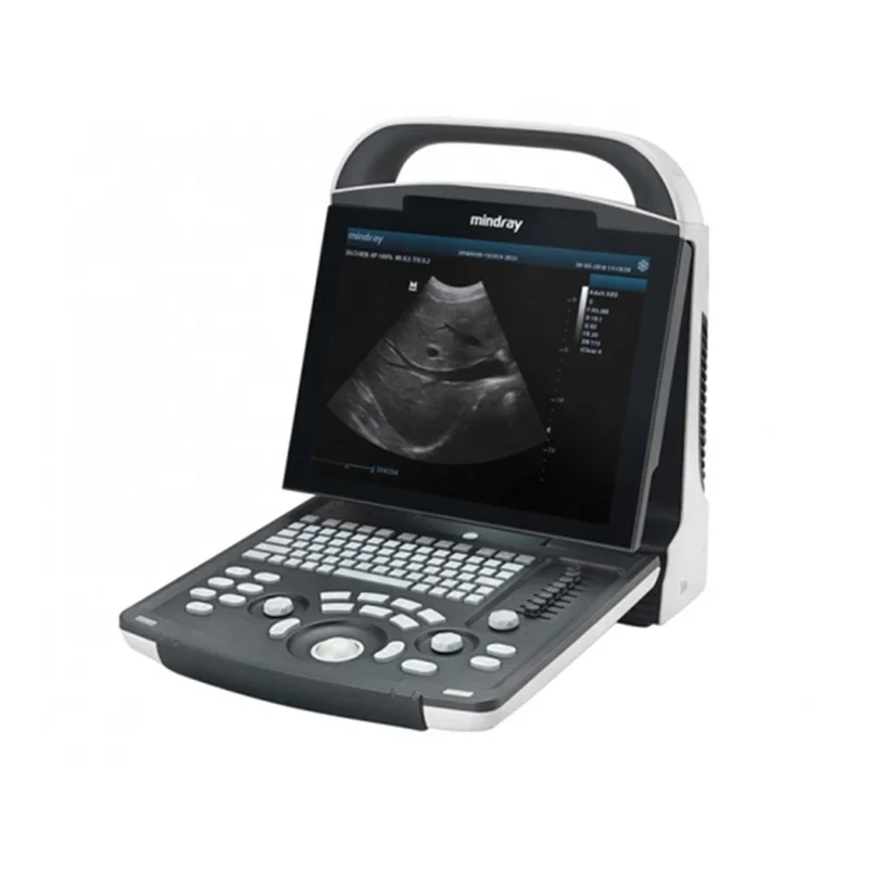 mindray ultrasound price