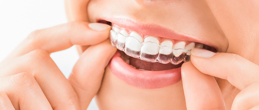 www invisalign doctor site