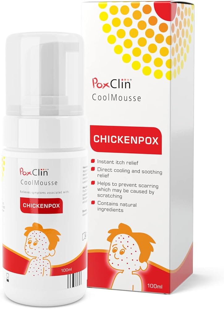 foam for chickenpox