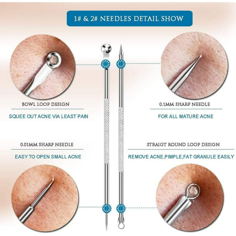 whitehead removal tool