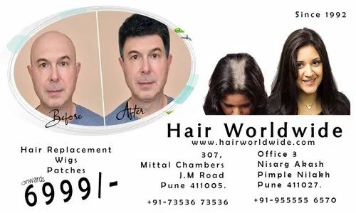 non surgical hair replacement in pune