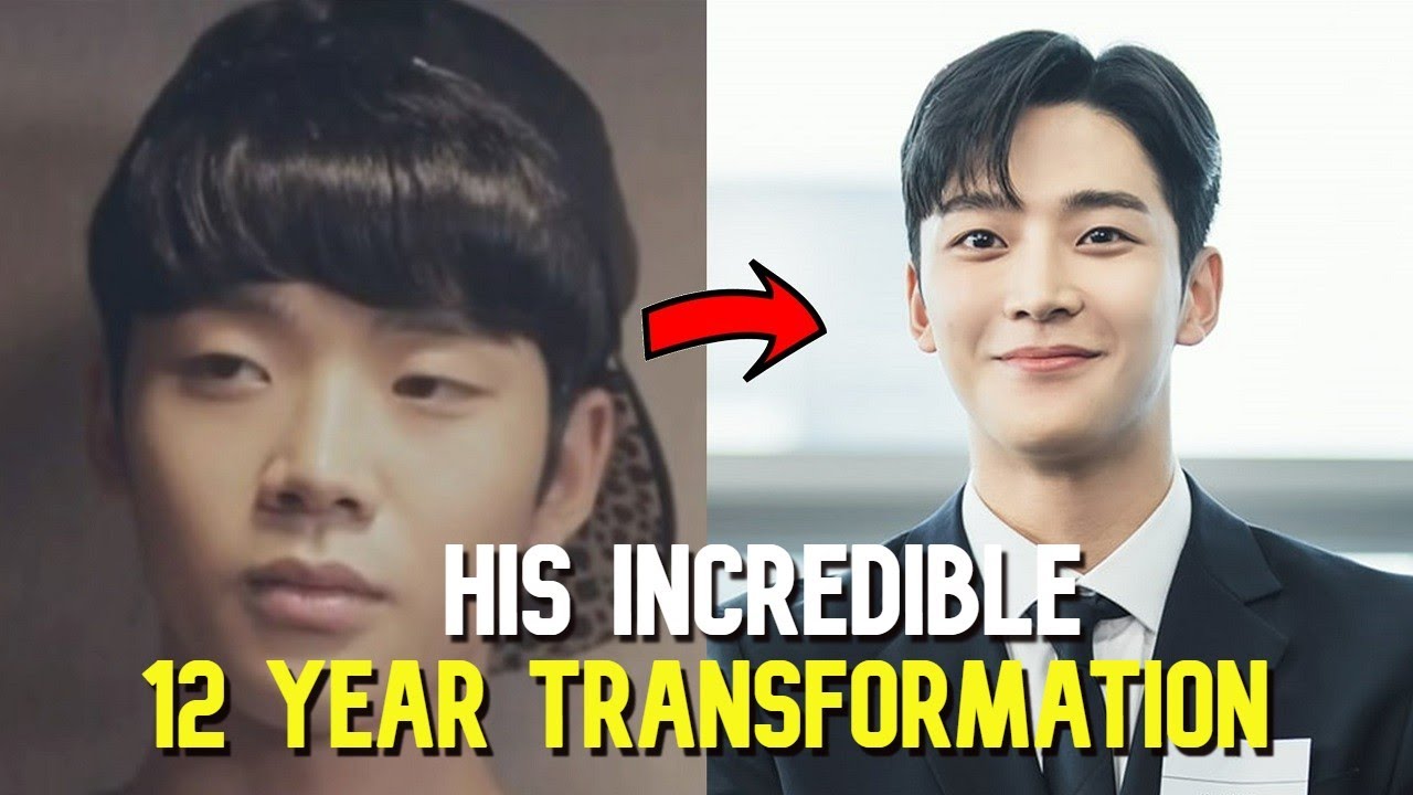 rowoon plastic surgery