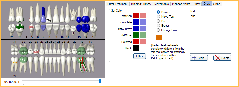 dental charting for beginners