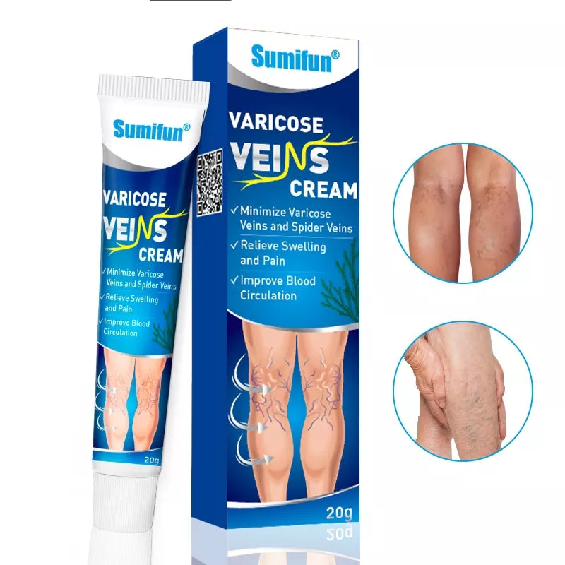 varicose veins relief cream reviews