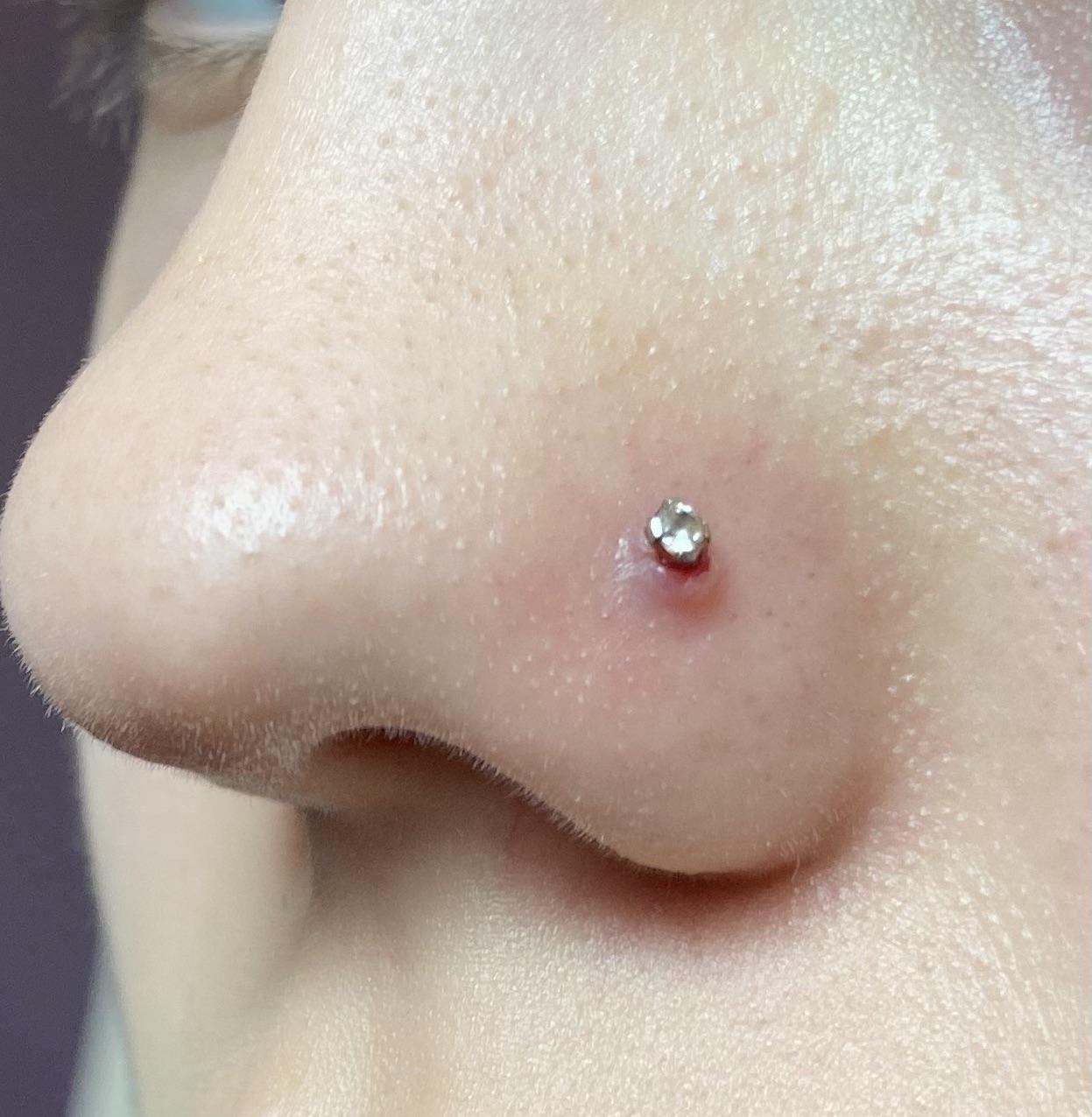 irritation bump nose piercing