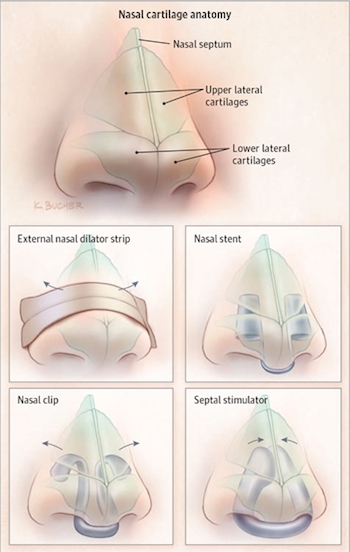 breathe right nasal strips review