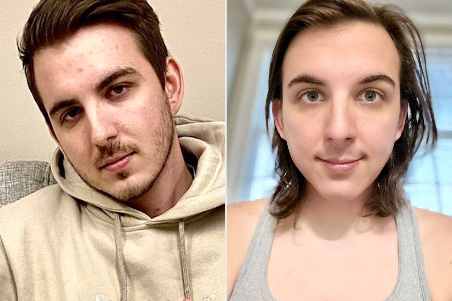 mrbeast transgender