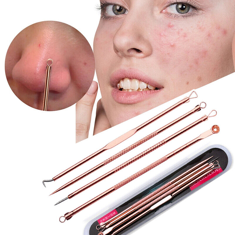 blackhead removal tool