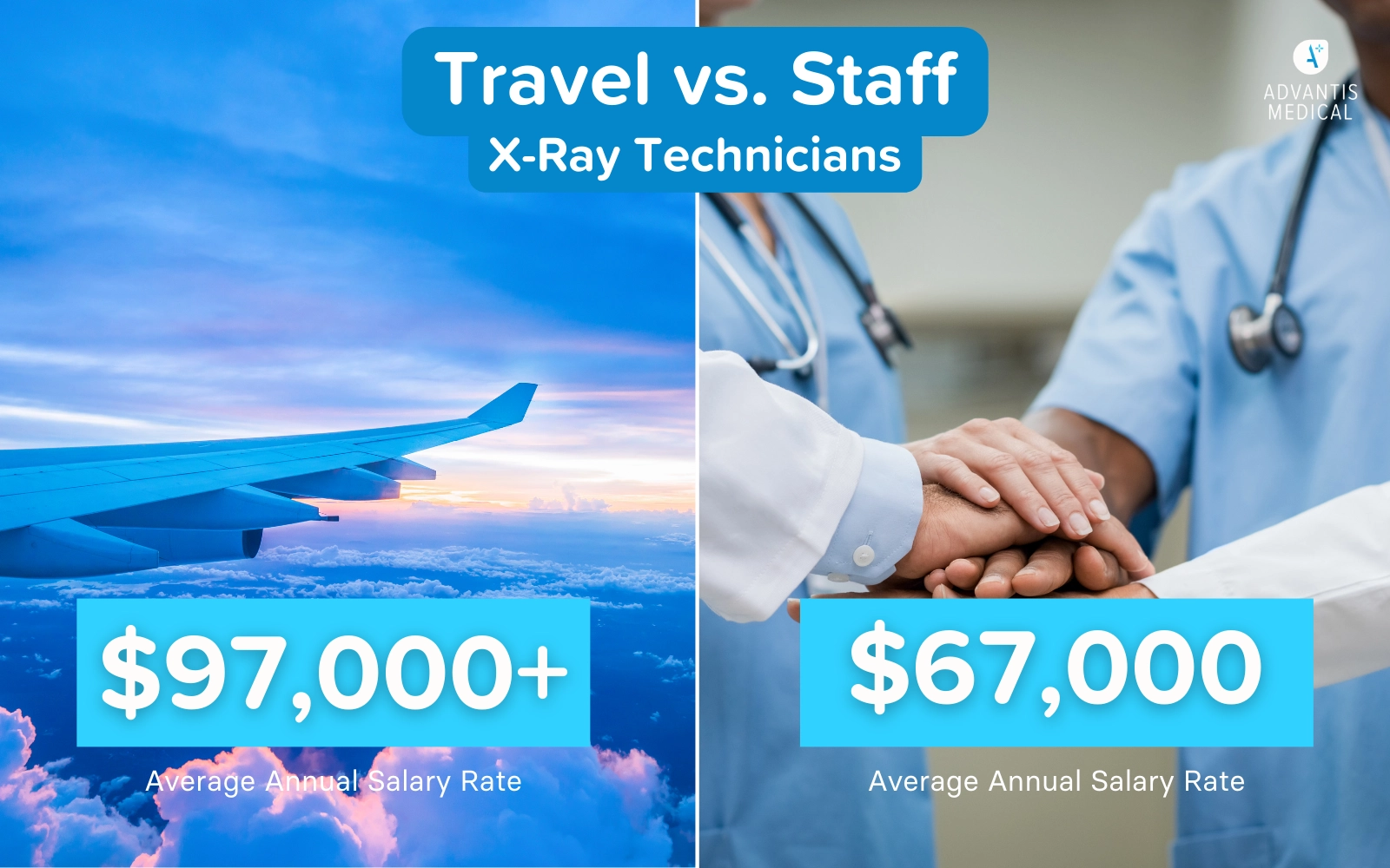 radiologic technologist salary california