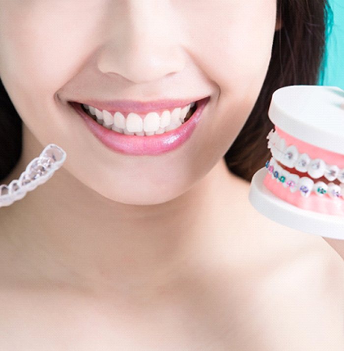 how much do braces cost in kansas city