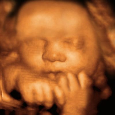 3d ultrasound brampton ontario