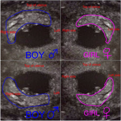 gender prediction ramzi theory