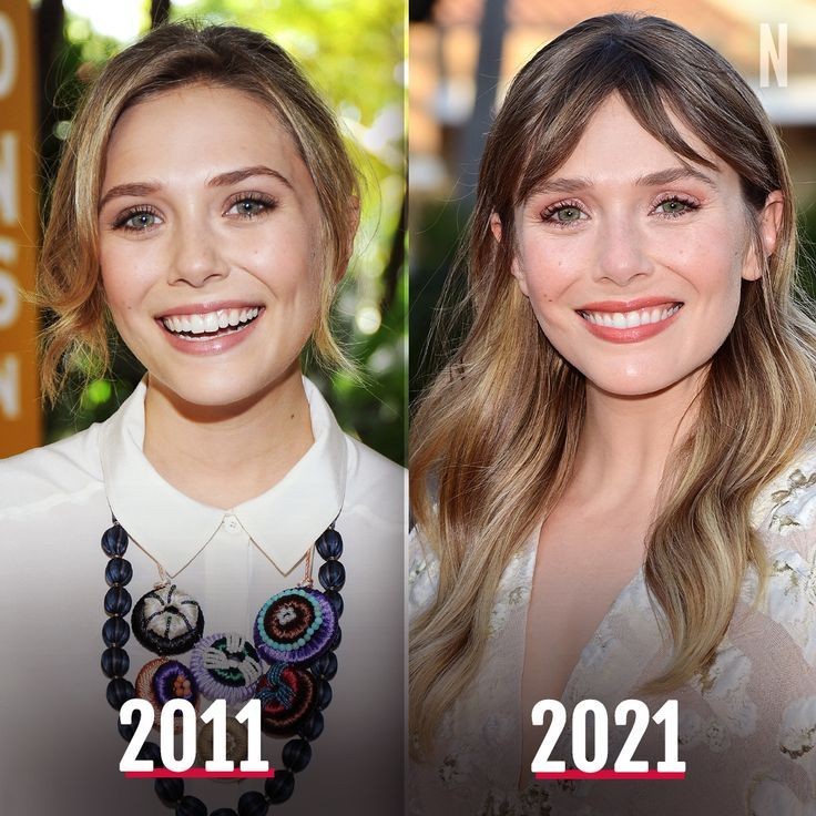 elizabeth olsen plastic surgery