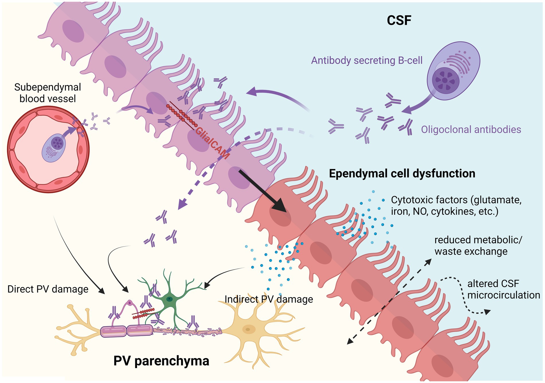 ependyma