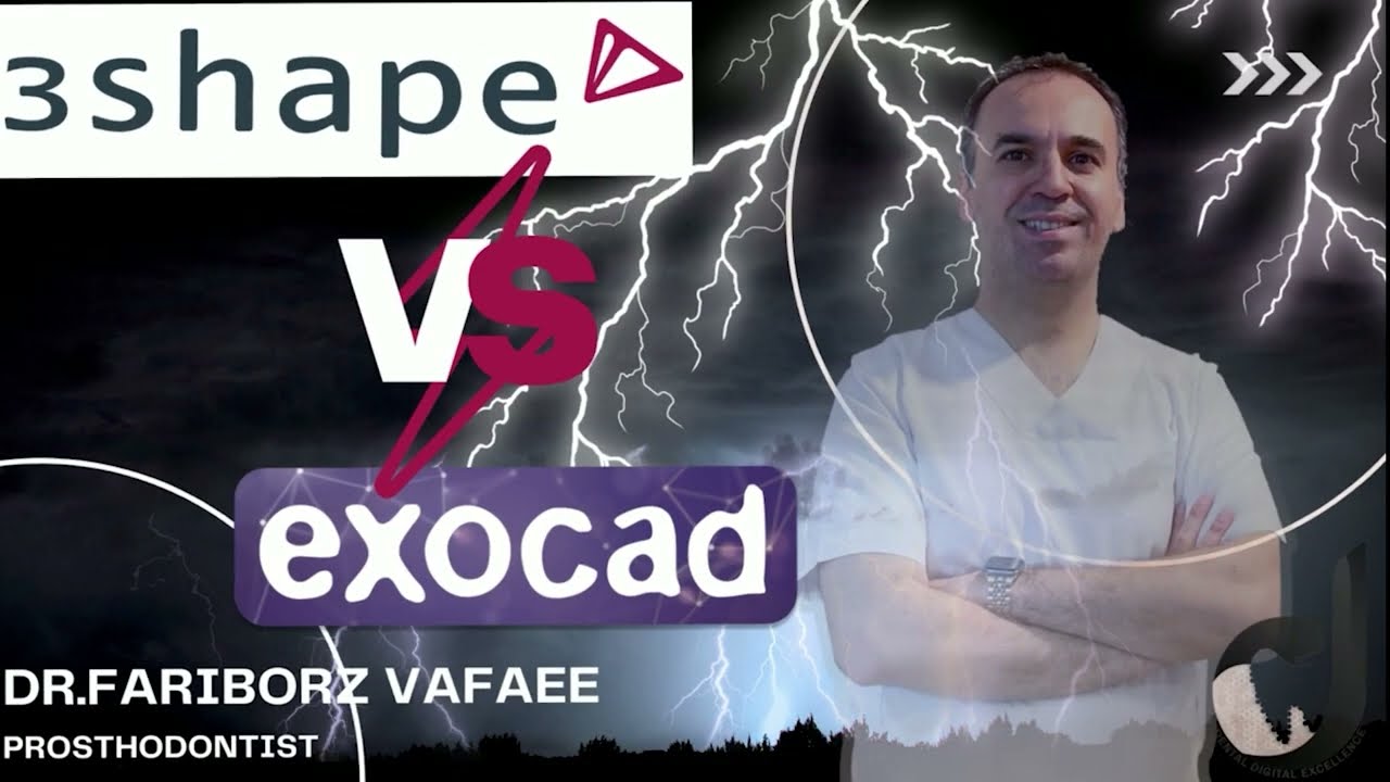 exocad vs 3shape