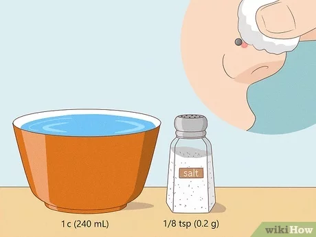 how to get rid of a piercing bump on nose