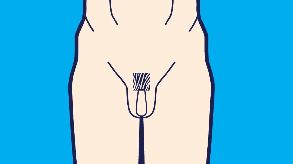 male pubic style