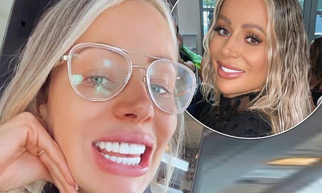 olivia attwood teeth