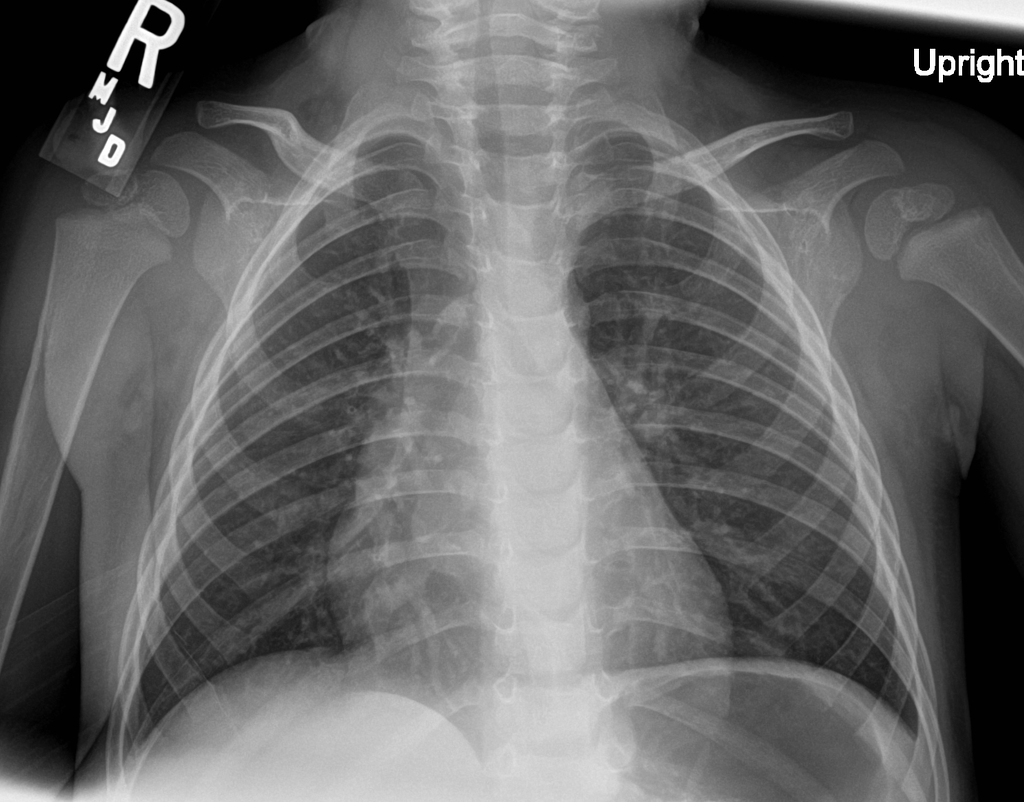 radiopaedia quiz