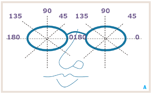 sph eye meaning in hindi