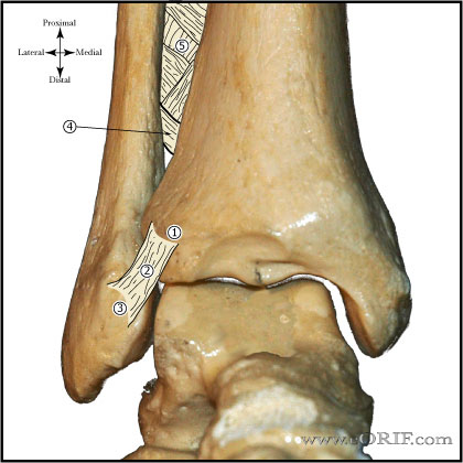 sprain of ankle icd 10