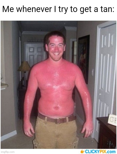 sunburn memes funny