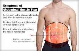 upper abdomen muscle spasm