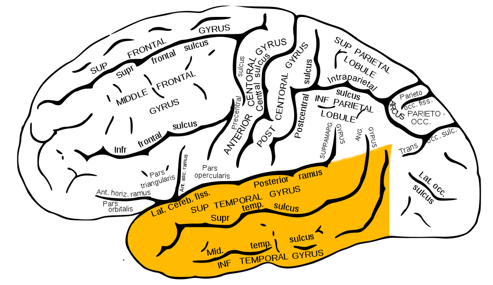 what is temporal lobe epilepsy